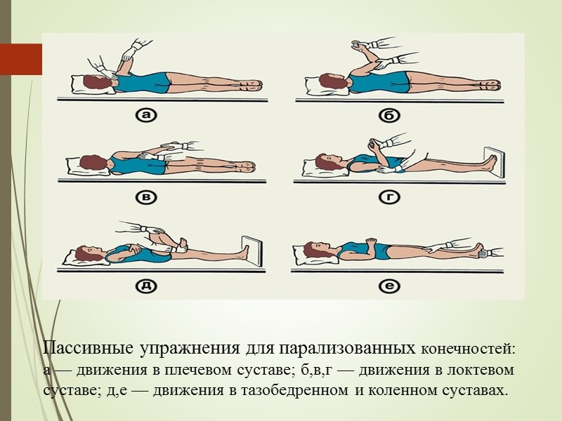 Пассивные упражнения для парализованных конечностей: а — движения в плечевом суставе; б,в,г — движения